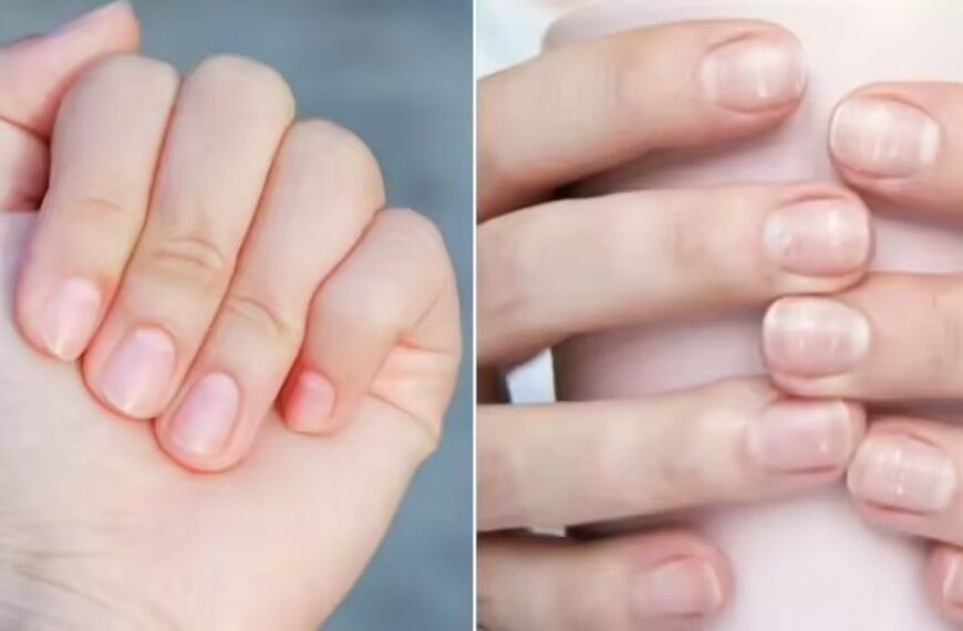 सेहत का हाल बताते हैं आपके नाखून, इन 5 संकेतों को न करें नजरअंदाज